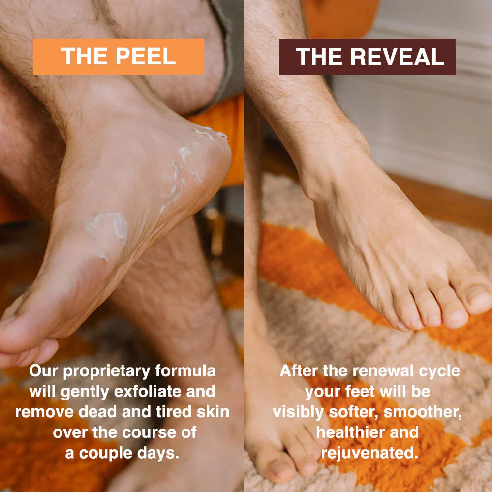 SeoulSkin Glycolic Acid Foot Peeling Mask (1 Pair), Korean Peeling & Exfoliating | Deep Exfoliation with Glycolic Acid, Removes Dead Skin, Cruelty-Free, Foot Peel Off Mask