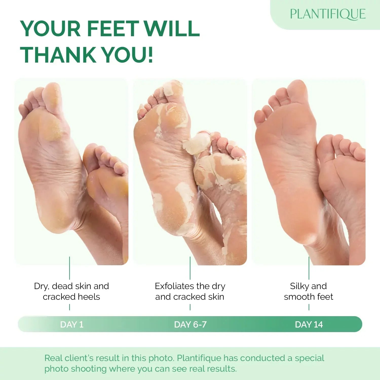 SeoulSkin Glycolic Acid Foot Peeling Mask (1 Pair), Korean Peeling & Exfoliating | Deep Exfoliation with Glycolic Acid, Removes Dead Skin, Cruelty-Free, Foot Peel Off Mask